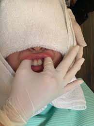 歯茎マッサージは行うべき？歯肉のアンチエイジングや引き締めに効果あり！ | アンチエイジングデンタルクリニック恵比寿