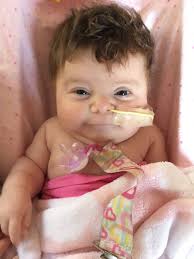 Truncus arteriosus — Shirley's Grand Adventure Blog — Shirley's Grand  Adventure