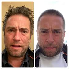 The Consort Services Directors Tony Barry and Paul Crew have shaved their  heads, along with 15 of their friends and raised thousands to help NHS  fight against coronavirus. 👏🏻👏🏻👏🏻 Click