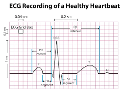 Long Qt Syndrome Knowledge Base Diagnosis Evaluation Electrocardiogram