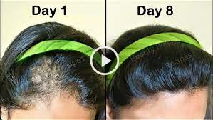 Pros explain how to permanently thicken fine hair naturally, including home remedies, what to eat, how to get thicker, fuller, longer hair overnight, in a week, and in a month. How To Make Hair Thick Strong Naturally At Home K4 Fashion