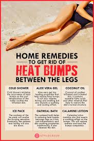 Top 10 Effective Home Remedies To Get Rid Of Heat Bumps Between The Legs Heat Bumps Heat Rash Treatment Skin Bumps