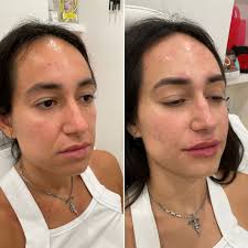 Beverly Hills Aesthetic Medics