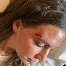 INCLINE VILLAGE COMMUNITY HOSPITAL