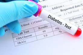 Image result for cukrovka hodnoty tabulka