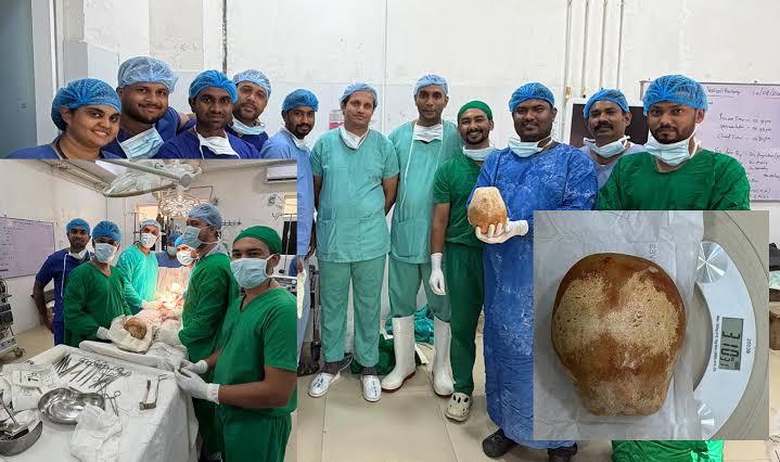 Bladder Stone Archives - Thinakaran