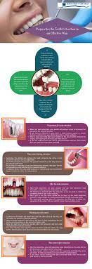 Eminent Tooth Extraction Bleeding Toothfairytime Toothextractioncare Tooth Extraction Healing Tooth Extraction Aftercare Wisdom Teeth