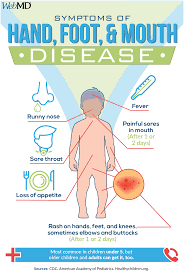 What is the treatment for hand, foot and mouth disease? Pin On Parenting