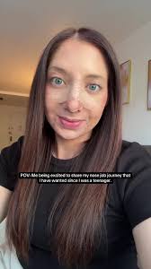 Understanding Negativity in Online Comments and Nose Jobs