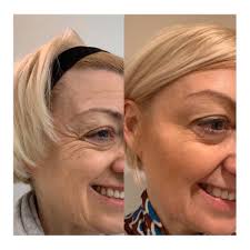 Dr Sillett Aesthetics added a new...