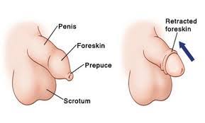 Image result for Phimosis