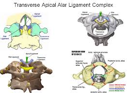 Atlantoaxial Instability Spine Orthobullets