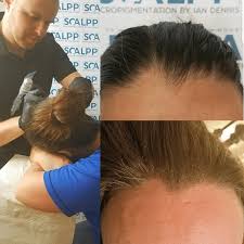 Scalp micro pigmentation news_singapore hairline embroidery hair tattoo smp scalp sg microblading hairline singapore koreans are now embroidering their hairlines to look young. Scalp Micropigmentation For Women Thinning Hair Houston Texas Austin Texas
