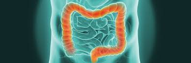 About one in 21 men and one in 31 women will develop bowel cancer before the age of 75. Colorectal Cancer Gi Cancer Institute