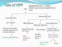Image result for Manual Rotation in Occipitoposterior Presentation