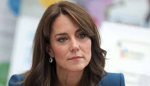 Did You Know That Kate Middletone Was Wearing Lingual Braces On Her Wedding  Day? They Are Bonded To The Back Of Th… | Lingual Braces, Teeth Braces,  Invisible Braces