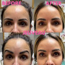 Casey Hunt (@caseyhunt_evolus) • Instagram photos and videos