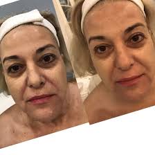 Holistic Aesthetician