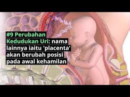 Pendarahan Awal Kehamilan Early Pregnancy Bleeding Punca