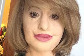 Fundraiser for Marni Castor by Jamie Lee White : Marni's Reconstructive  Surgery