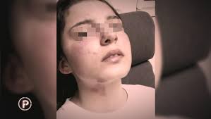 Djevojčica koju je brutalno pretukao otac: "Svi postupaju sa mnom kao da  ništa ne razumijem. A ja sve znam, ja sam to proživjela"