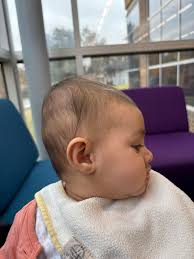 Hi Mom's. I really need an input if you think my baby head shape looks off?  She just turned 5 months this month and i feel like her head doesn't look  right.