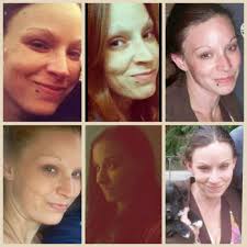 I'm so blessed to say I've made it to 35 today!🎉. Thank God for his  mercy🙏🏼,my family for supporting me👨‍👩‍👧‍👧modern medicine💉💊🌡, and  my doctors and nurses who took care of me through