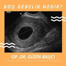 ultrasonda bebek ve kalp atimlarinin gorulmesi gereken haftalarda gebelik kesesinin bos olarak gorulmesi bos gebelik olarak tanimlanir halk arasinda diger bir a