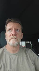 Guy Gwts Stingray Barb Stuck in Arm