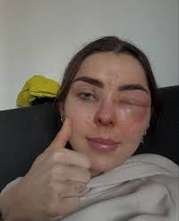 ONE DAY I WILL RUN AGAIN!!❤️🙏RunningThreads