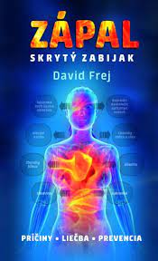 Tieto potraviny ho udržia v dobrej kondícii. Zbavte Sa Zapalu V Tele Webnoviny Sk