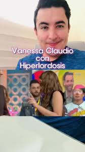 La #hiperlordosis de @Vanessa Claudio Rodr @Venga La Alegría #VLA  #lumbalgia #lumbar #lumbares #dolordeespalda #espaldabaja #vengalaalegria