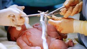 Then rinse with plain water and pat it dry. How To Clean Baby Belly Button After Umbilical Cord Falls Off