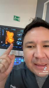 Cuantas #ecografias debe hacerse una #embarazada durante todo el proceso de  gestación? 🙀, Aquí nuestro especialista nos explica cuales son las  ecografías imprescindibles para llevar tu embarazo a ...