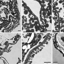 Image result for Hypolytrum heteromorphum