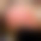 Image result for Flail Chest