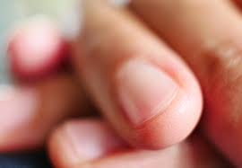 White and chalky toenails from nail polish. 6 Things Your Nails Say About Your Health Cleveland Clinic