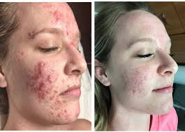 Professional Skincare