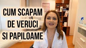 Laserul este cea mai eficienta, biocompatibila, blanda si nedureroasa metoda de tratare a cariilor. Indepartare Papiloame Si Veruci Dr Dana Bratu