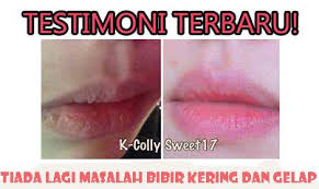 Lagi testimoni pengguna nour ain. Facebook