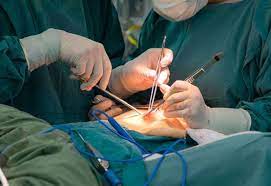 بالصور استخراج 20 ملعقة ومجوهرات من بطن مريض مصري n e e t medical surgery