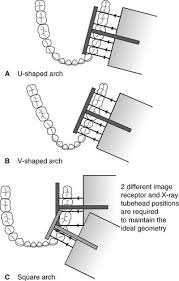 8 Bitewing Radiography Pocket Dentistry