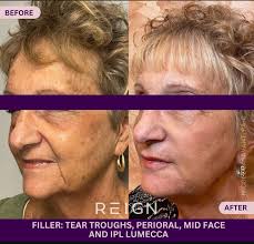 Rogue Mens Aesthetics We are your premier destination for men's facial  treatments. Specialising in tailored aesthetics, we offer a range of  services including facials, skin rejuvenation and anti-aging therapies  designed specifically for