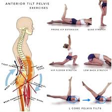 Anterior Tilt Pelvis I Get So Many Dm S And Messages And Although I Do Read Them All I Just Don T Have The Time Scoliosis Exercises Exercise Massage Therapy