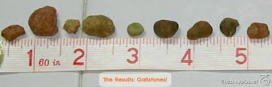 Pin On Liver Detox