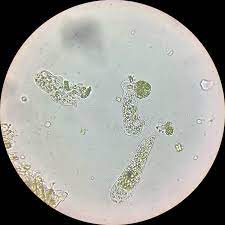 These blobs of life live everywhere around us, but only a few of us will ever see them, until now. The Amoeba Boys From The Powerpuff Girls In Real Life 400x Microscopy