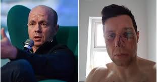 Tyrone Peter's Instagram, Twitter & Facebook