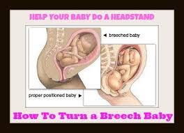 Help Your Baby Do A Headstand How To Turn A Breech Baby Yoga Janda Breech Babies Turn A Breech Baby Breech Baby Exercises