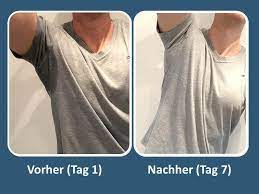 Was Tun Gegen Starkes Schwitzen Was Mir Wirklich Gegen Mein Schweissproblem Geholfen Hat Youtube