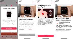 Apple Watch ECG app: What cardiologists want you to know - CNET